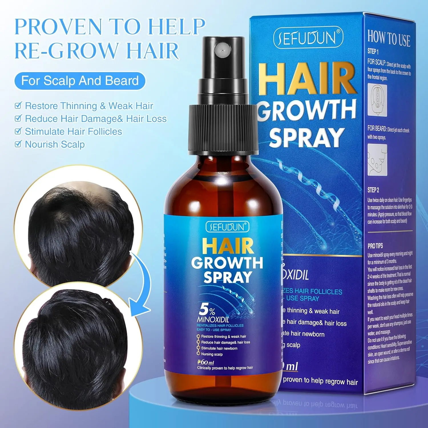 2 PACK 5% Minoxidil Hair Growth Spray for Thinning and Weak Hair, Scalp Treatment to Regrow Hair, Reduce Damage and Hair Loss for Men and Women, 2.02 OZ