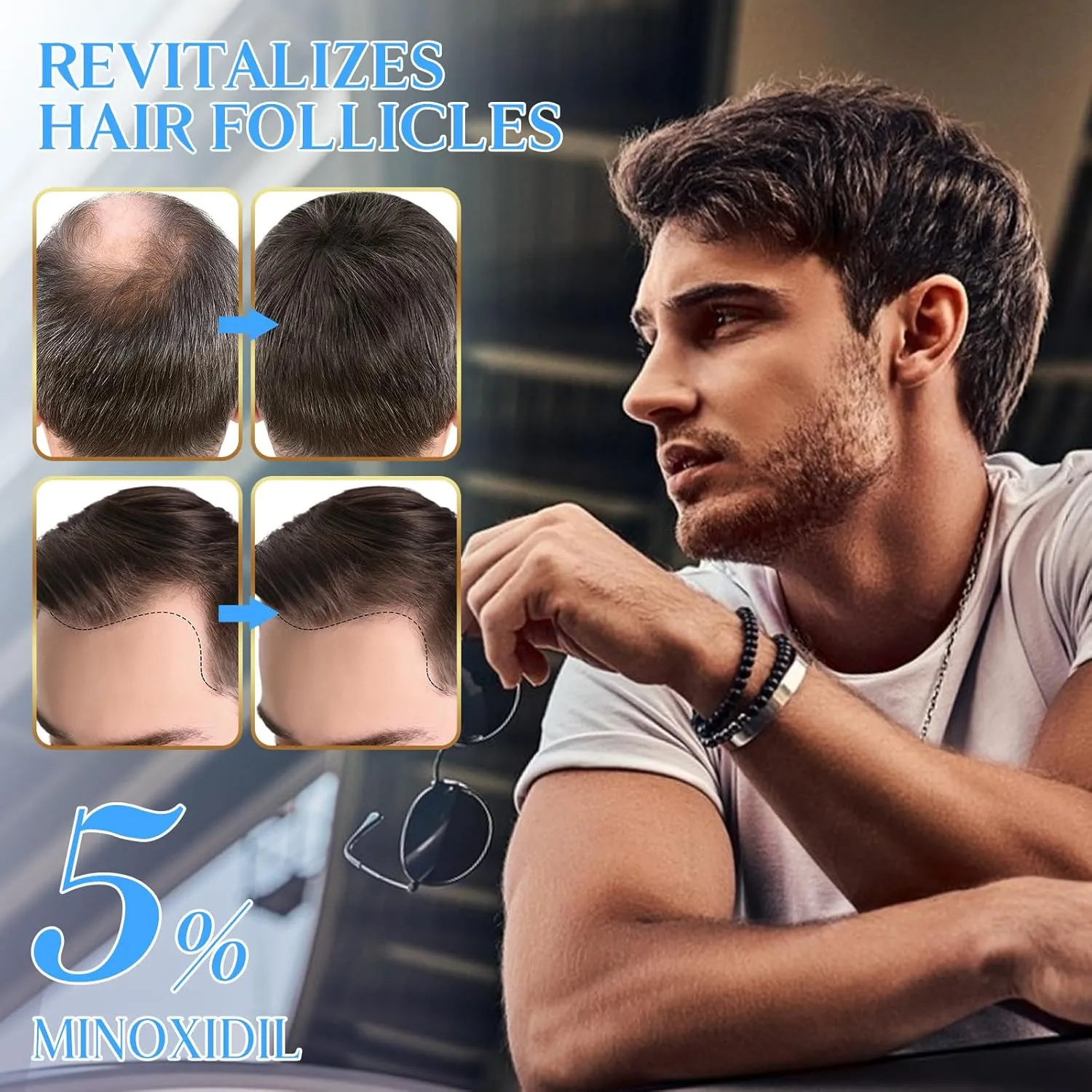 2 PACK 5% Minoxidil Hair Growth Spray for Thinning and Weak Hair, Scalp Treatment to Regrow Hair, Reduce Damage and Hair Loss for Men and Women, 2.02 OZ